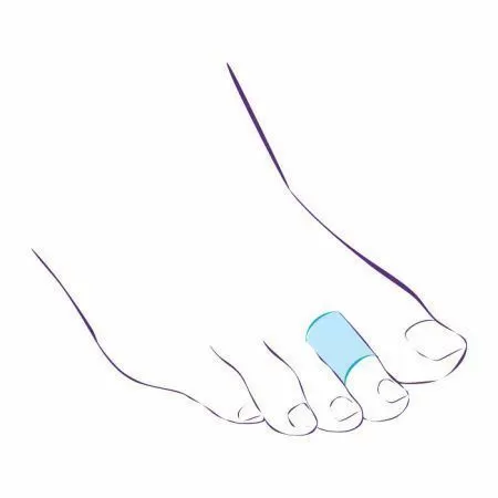 Напальчник Тривес СТ-45 от мозолей и натоптышей, силиконовый, 2 шт