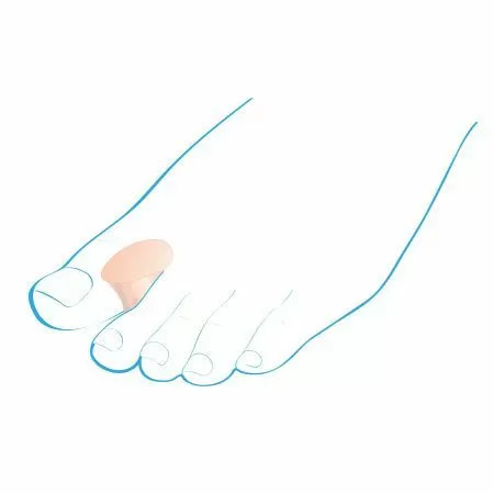 Разделитель межпальцевый Крейт С-400 силиконовый, 2 шт